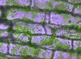 /album/galeria-de-fotos-microscopia-3-plastos/elodea-40x-jpg/